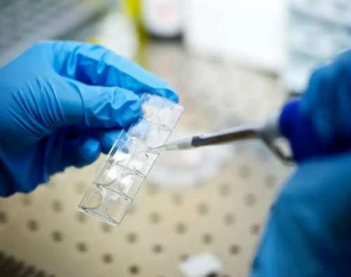 <strong>孕酮值超过20时，宫外孕的可能性降低吗？</strong>