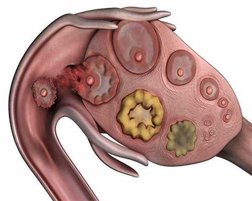 试管婴儿移植的最佳时间是什么时候？试管婴儿移植前后需要注意什么？