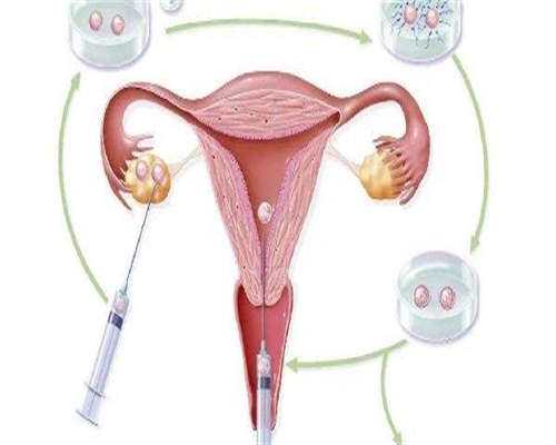 子宫内膜薄能直接做试管么,子宫内膜薄能做试管婴儿吗