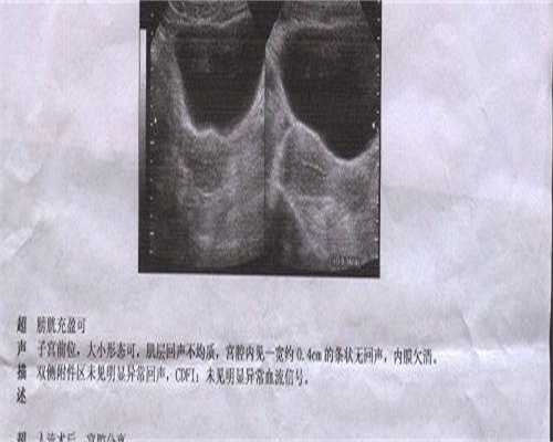 衢州正规试管机构成功率排名，三代试管优势很明显