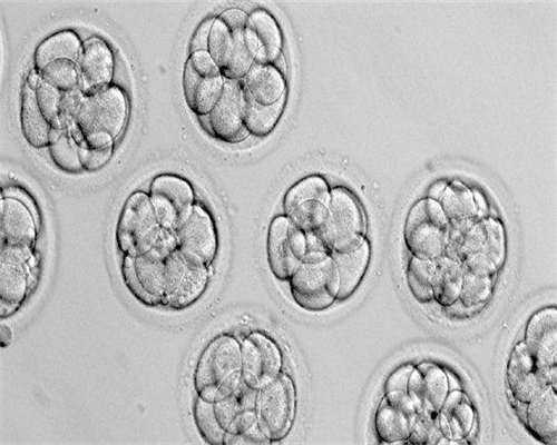 结扎做试管要多久完成移植？结扎做试管要多久完成移植成功？
