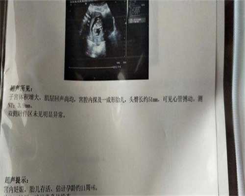 两条杠没怀孕是怎么回事
						