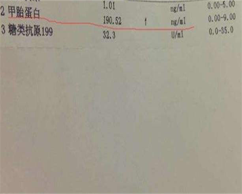 衢州十大试管婴儿医院排名哪家医院好!国内能做吗?