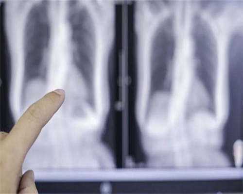 试管婴儿移植前后得花多少钱